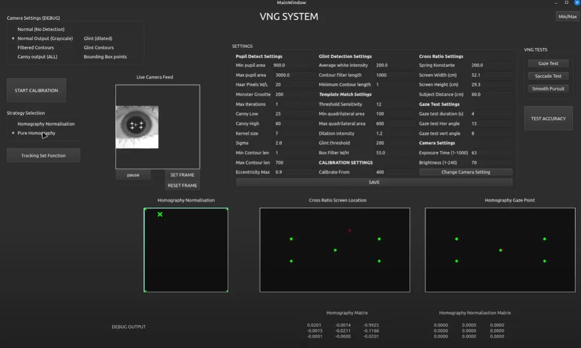 Videonystagmography System